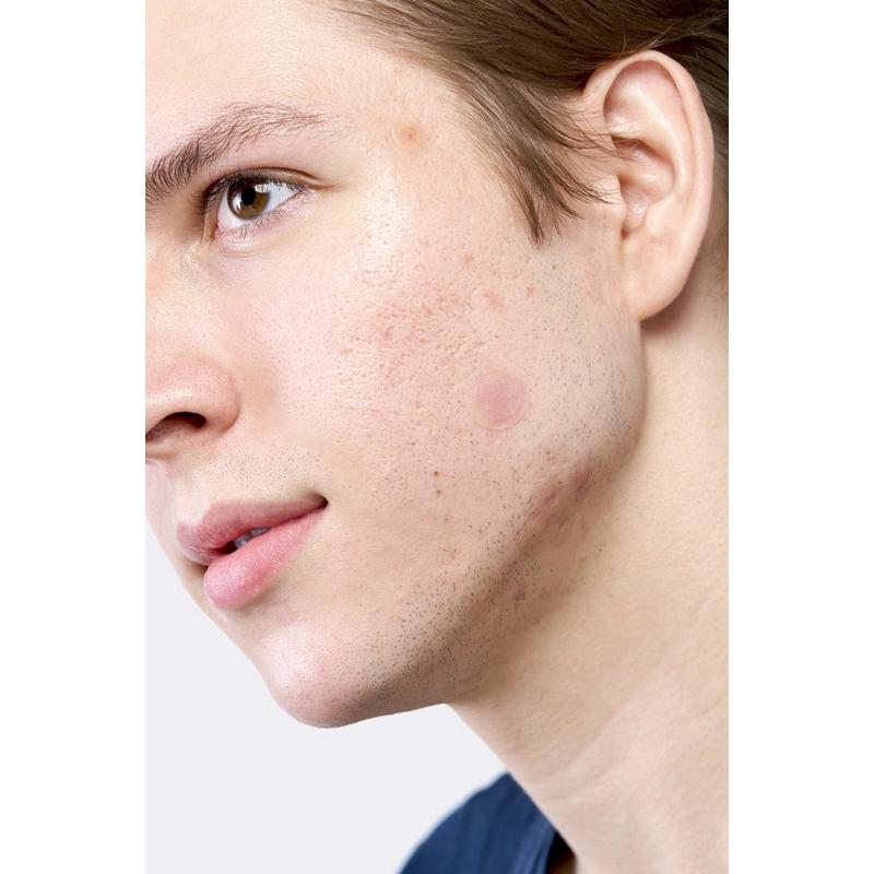 Hero Cosmetics Mighty Patch Micropoint for Blemishes Patches #9