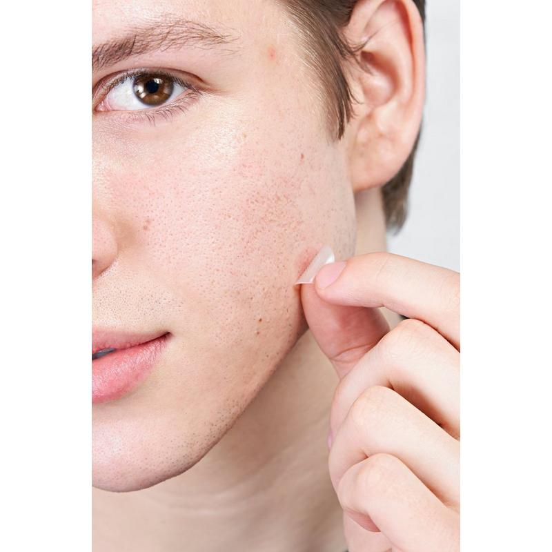 Hero Cosmetics Mighty Patch Micropoint for Blemishes Patches #10