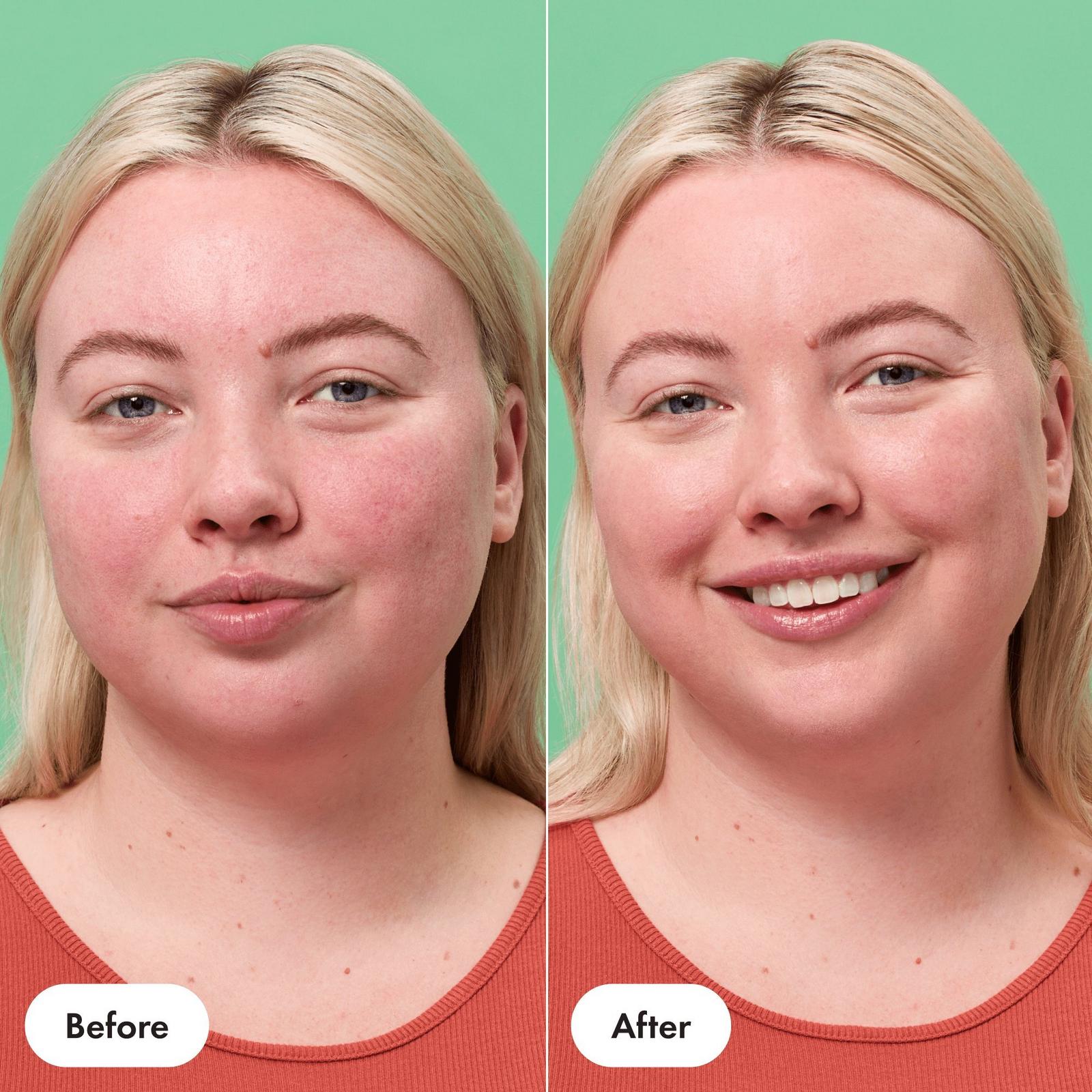Rescue Balm +Red Correct Post-Blemish Recovery Cream
