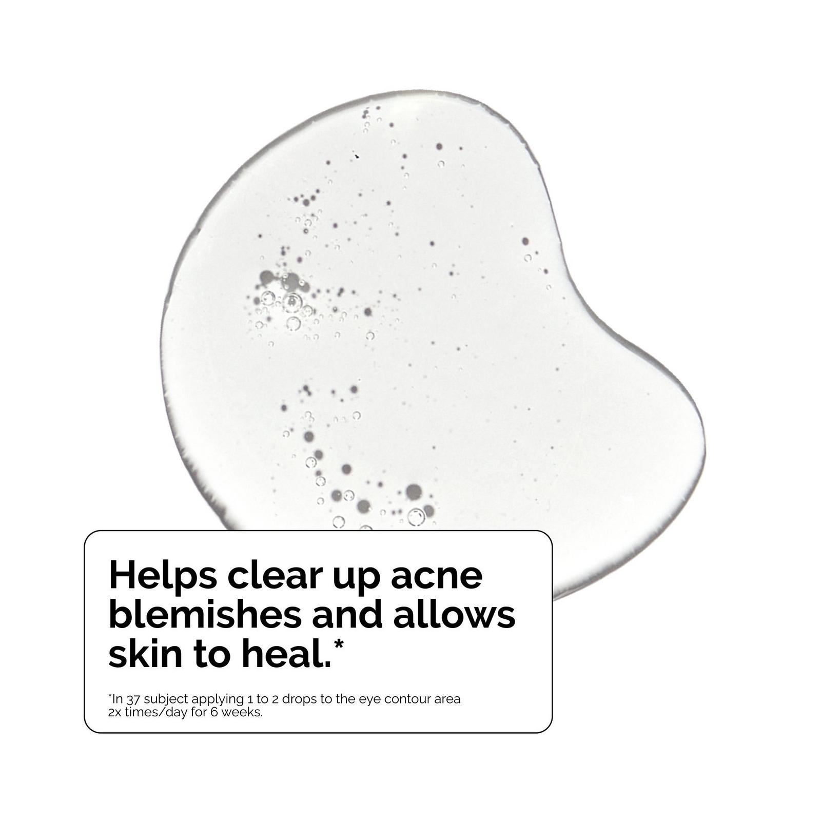Salicylic Acid 2% Solution Serum