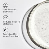 The Ordinary Salicylic Acid 2% Solution, Exfoliating Serum for Acne #2