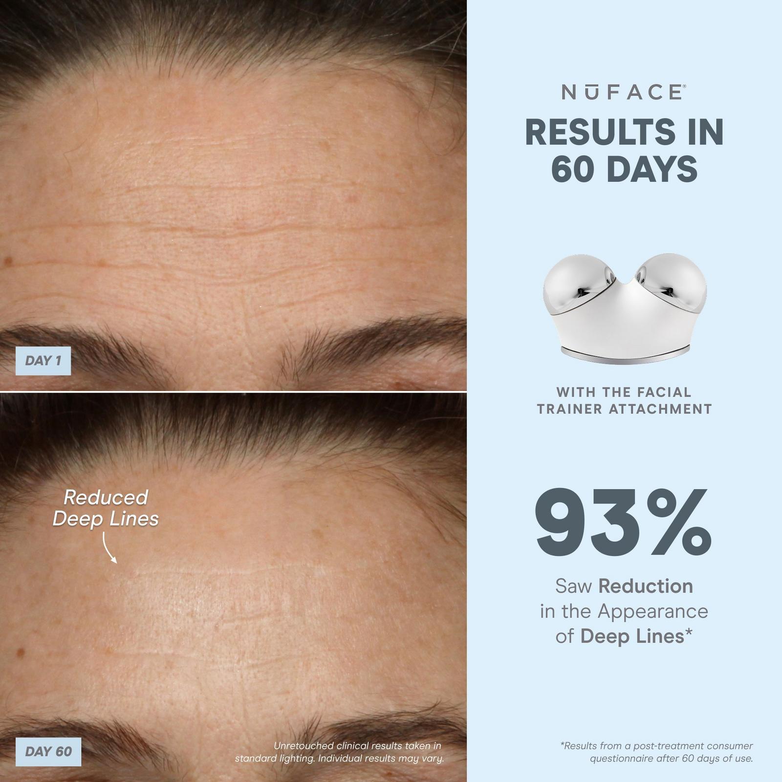 TRINITY+ Starter Kit Smart Advanced Facial Toning Kit