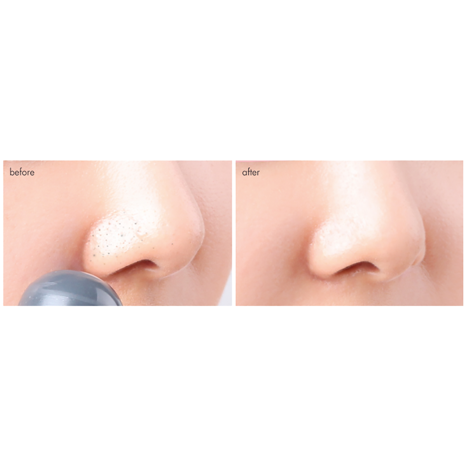 Tako Pore Blackhead Scrub Stick