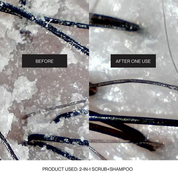 NatureLab. Tokyo Perfect Clean Scalp Rinse #7