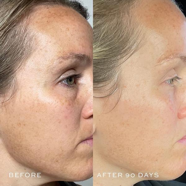DIME TBT Serum with Mandelic Acid + Peptides #8