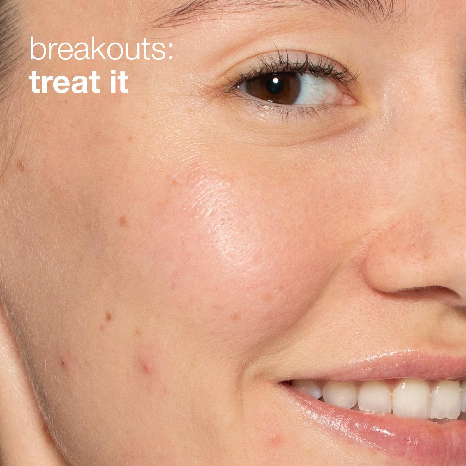 Clear and Brighten Skincare Kit