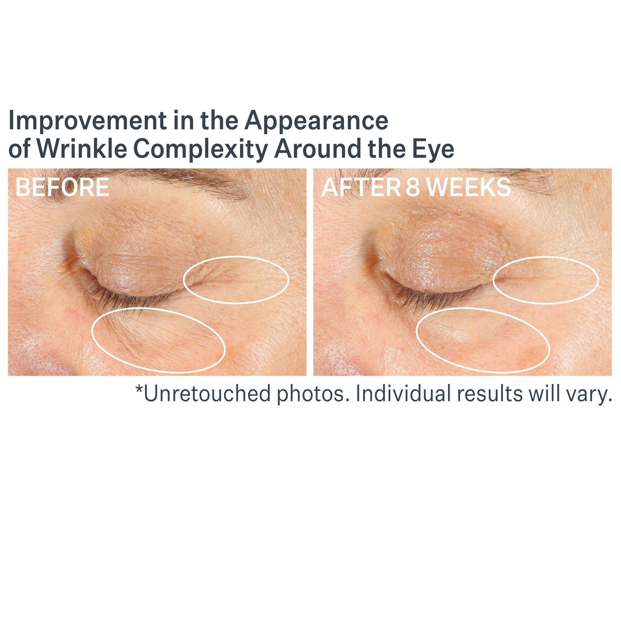 Корректирующий крем для век StriVectin Advanced Retinol Multi-Correct — фото 6