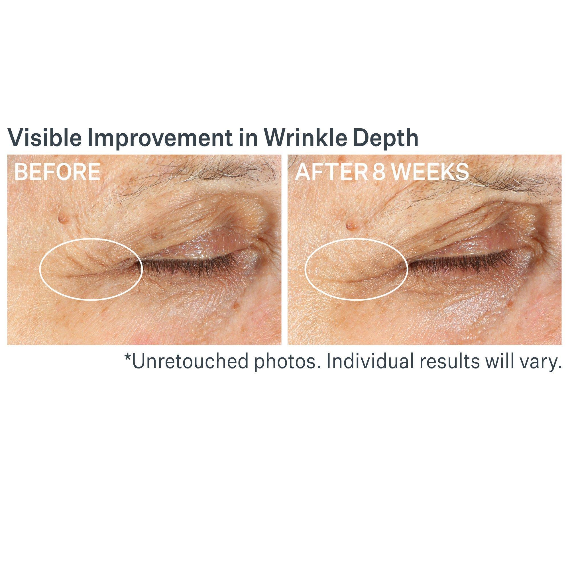 Корректирующий крем для век StriVectin Advanced Retinol Multi-Correct — фото 7
