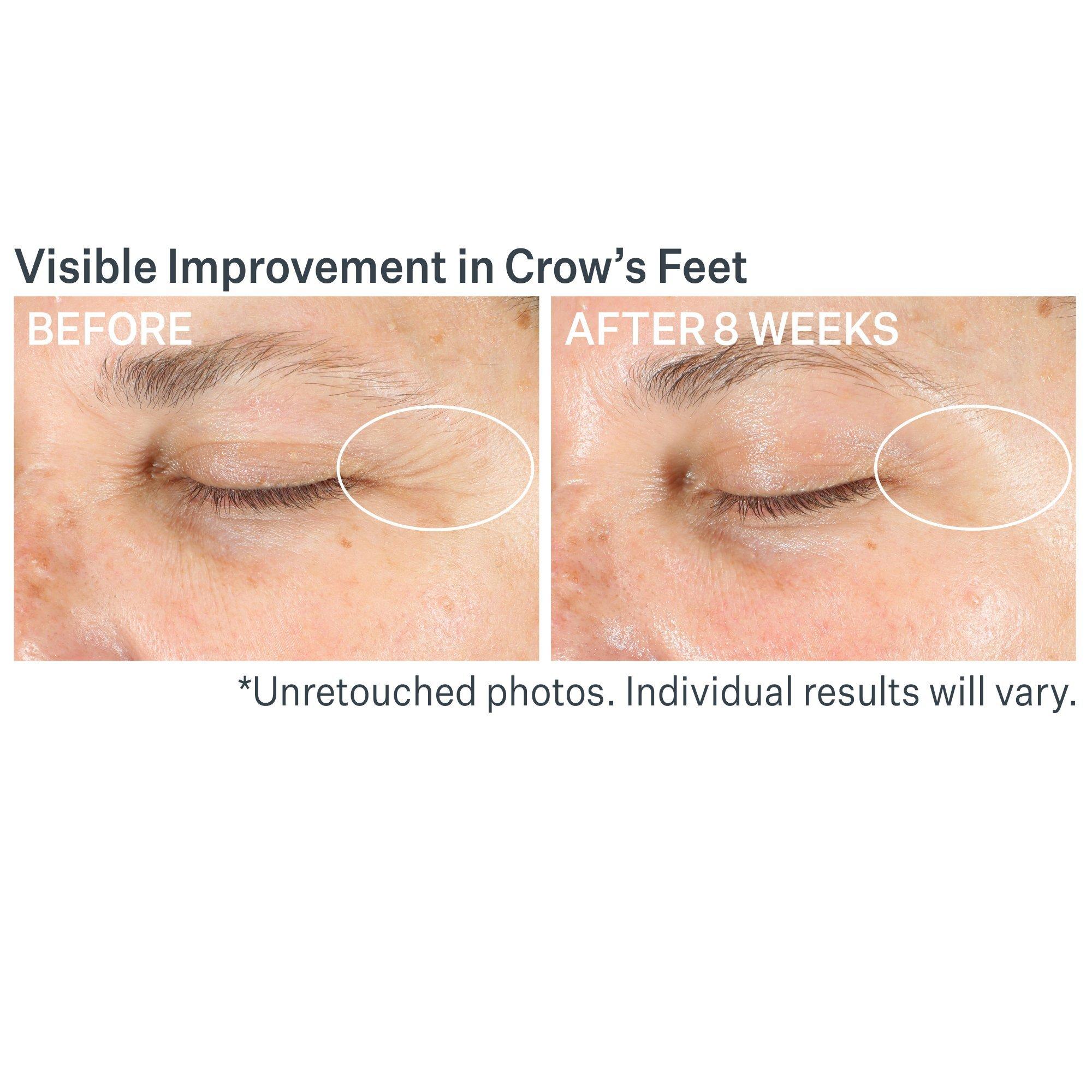 Корректирующий крем для век StriVectin Advanced Retinol Multi-Correct — фото 8