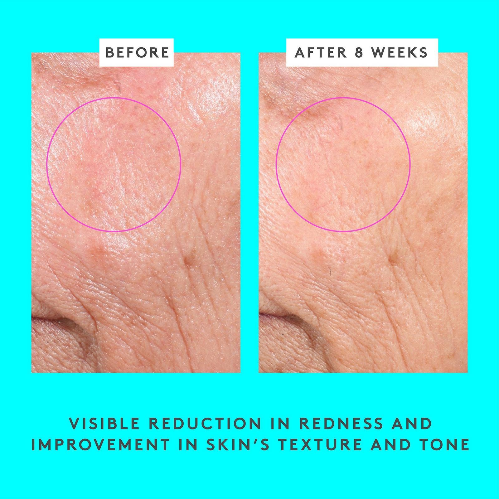 Bouncy Brightfacial Brightening Mask