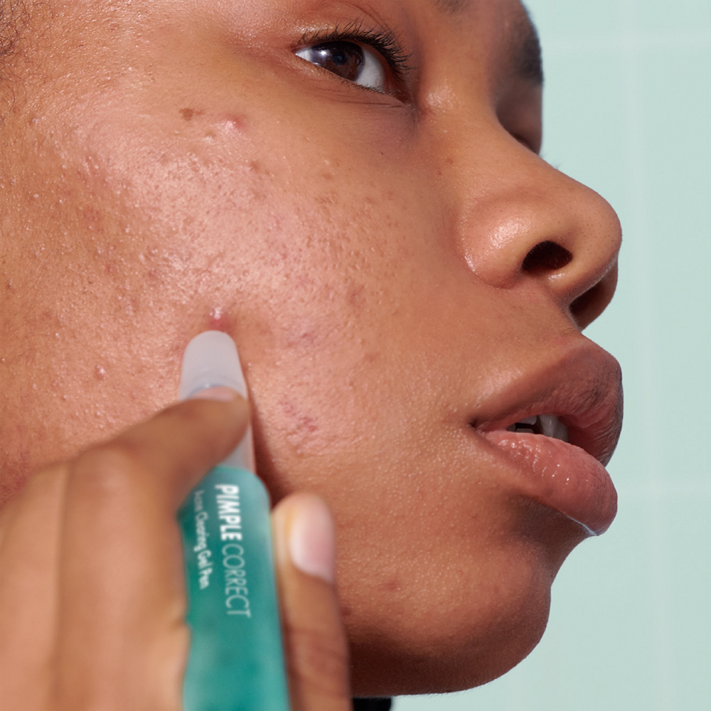 Pimple Correct Acne Clearing Gel Pen