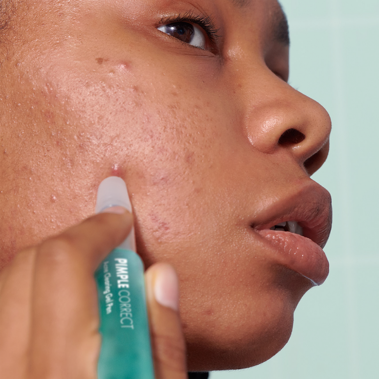 Pimple Correct Acne Clearing Gel Pen