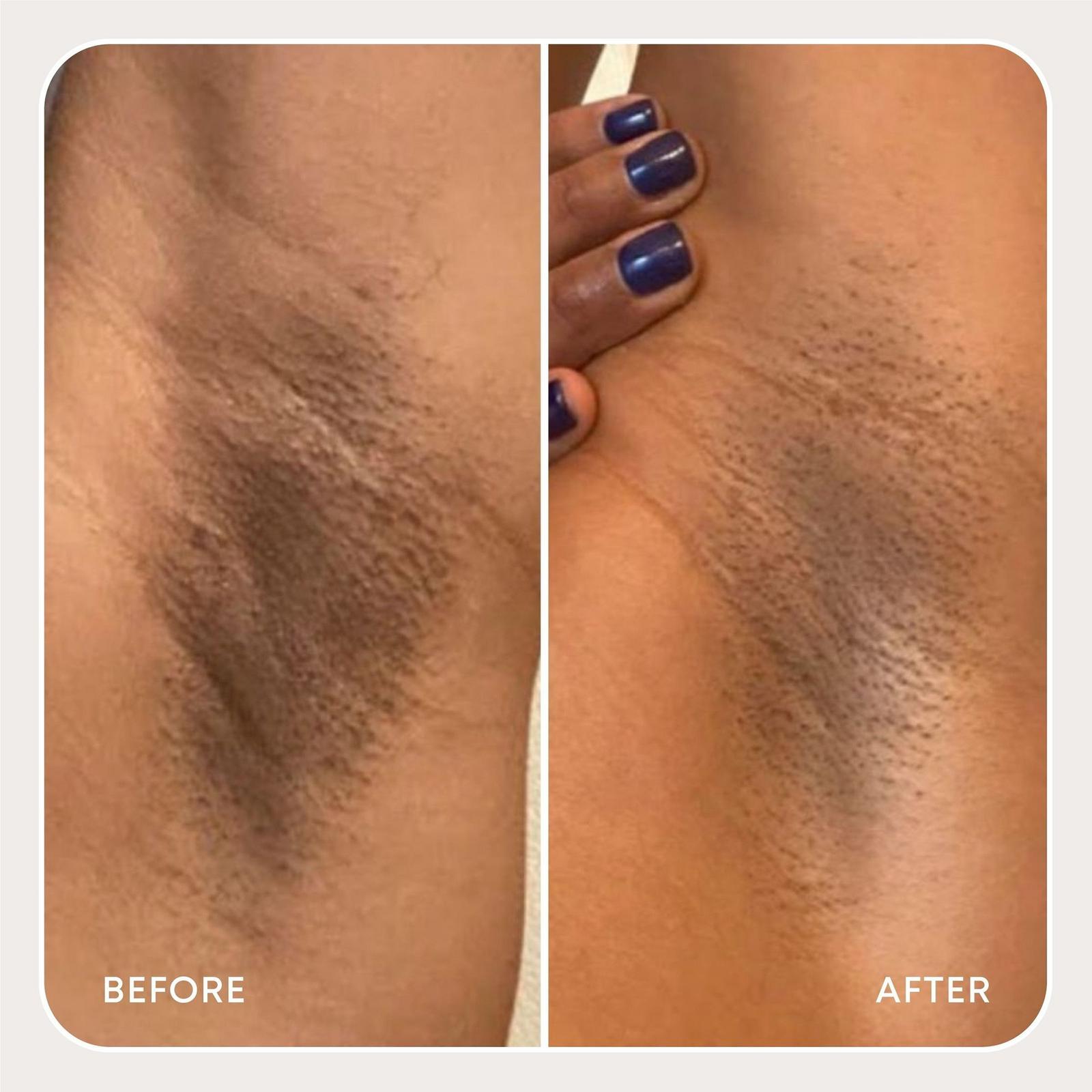 Dark Spot Oil