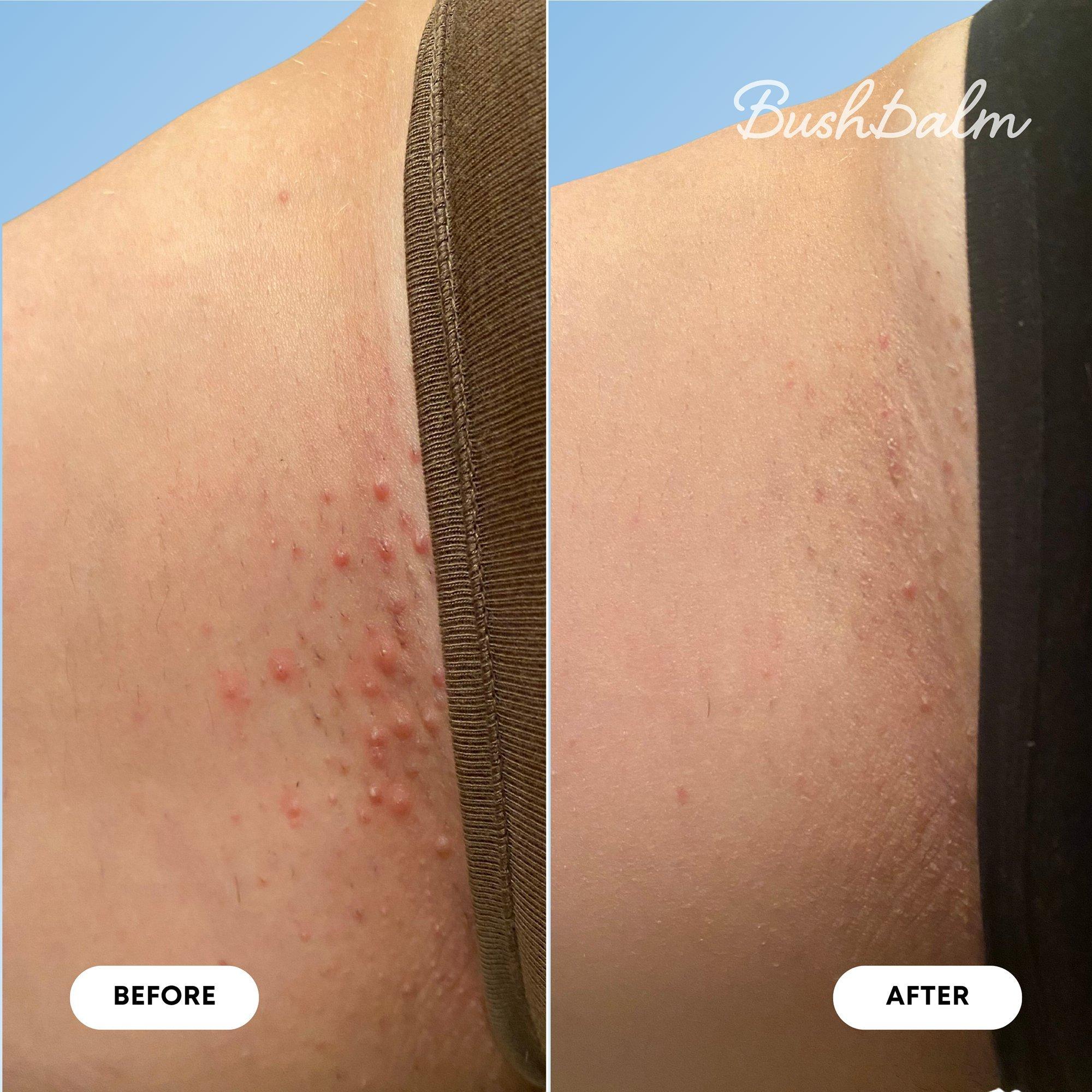 Масло от вросших волос Bushbalm — фото 7