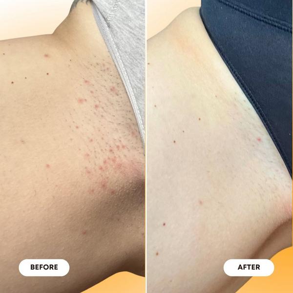 Bushbalm Ingrown Hair Oil #6