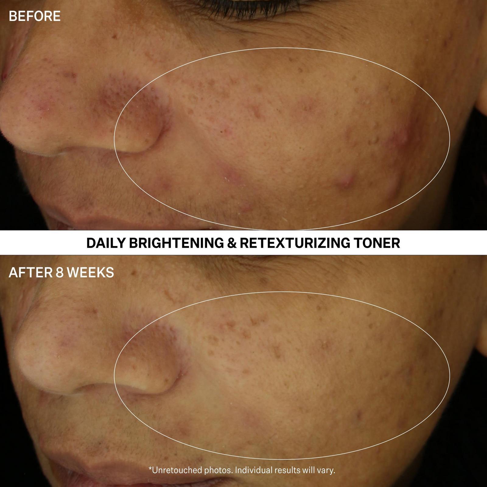 Multi-Action Clear Daily Brightening & Retexturizing Toner