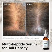 The Ordinary Multi-Peptide Serum for Hair Density for Thicker, Fuller Looking Hair #3