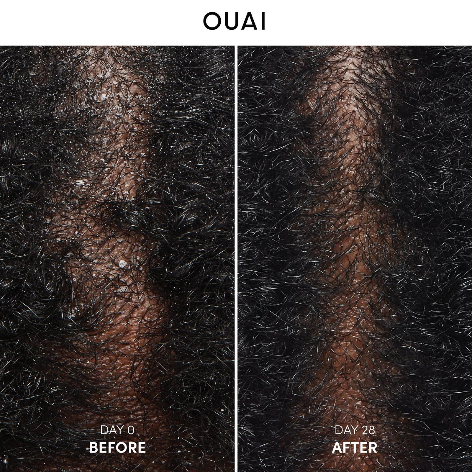 Anti Dandruff Shampoo