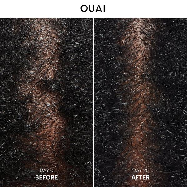 OUAI Anti-Dandruff Shampoo #3