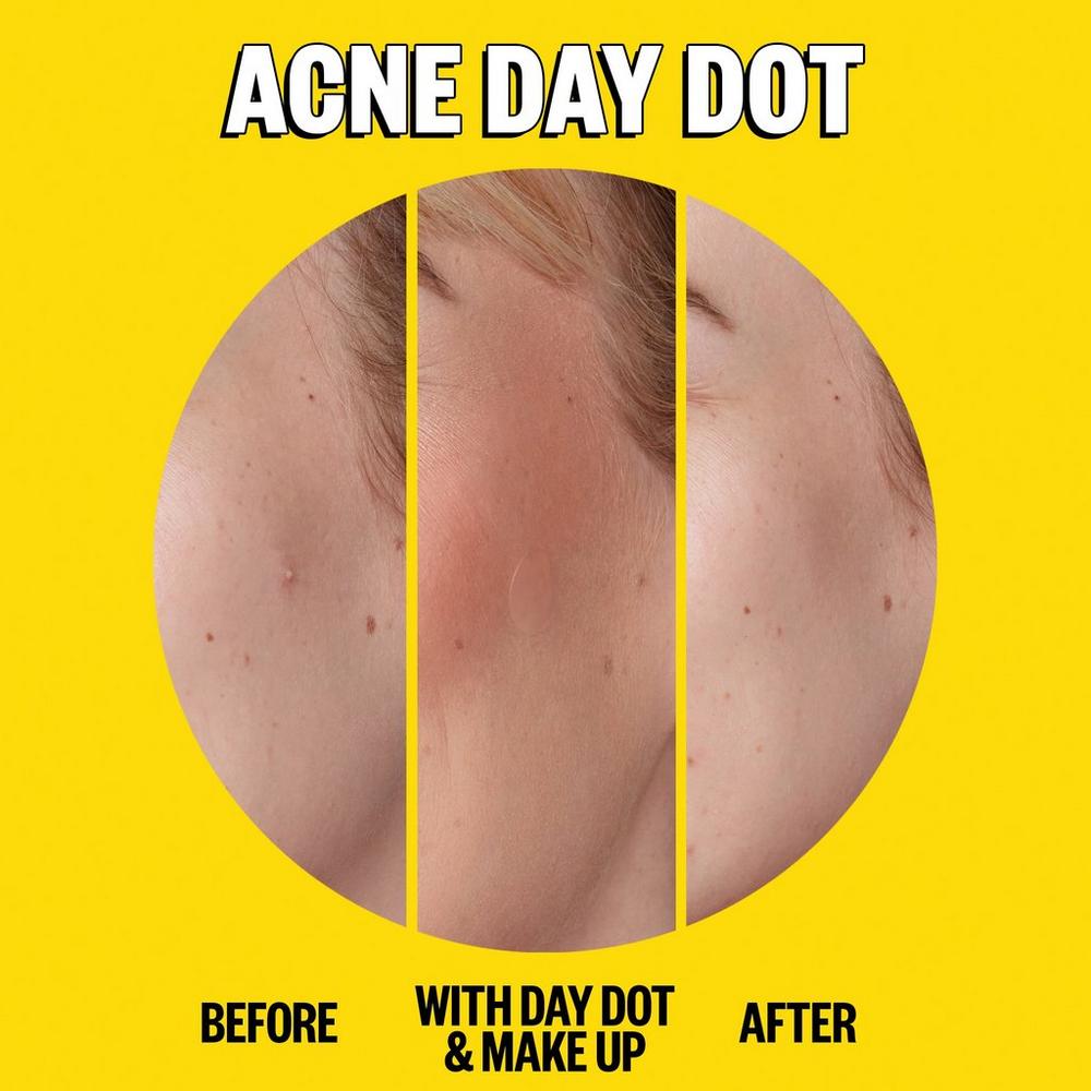Salicylic Acid Day & Night Duo