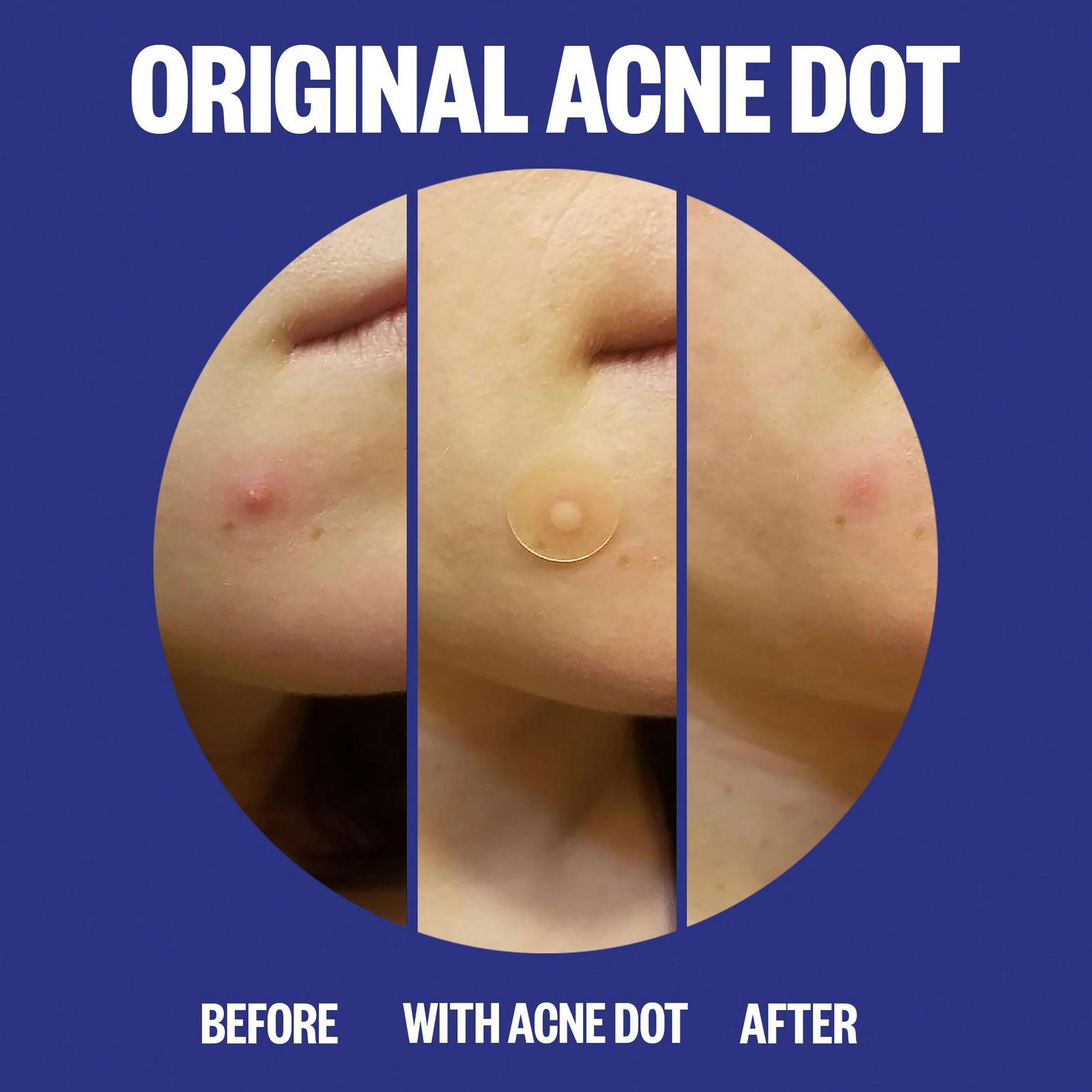 Salicylic Acid Day & Night Duo
