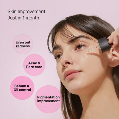 The Niacinamide 15 Serum with Acetyl Glucosamine + Zinc PCA
