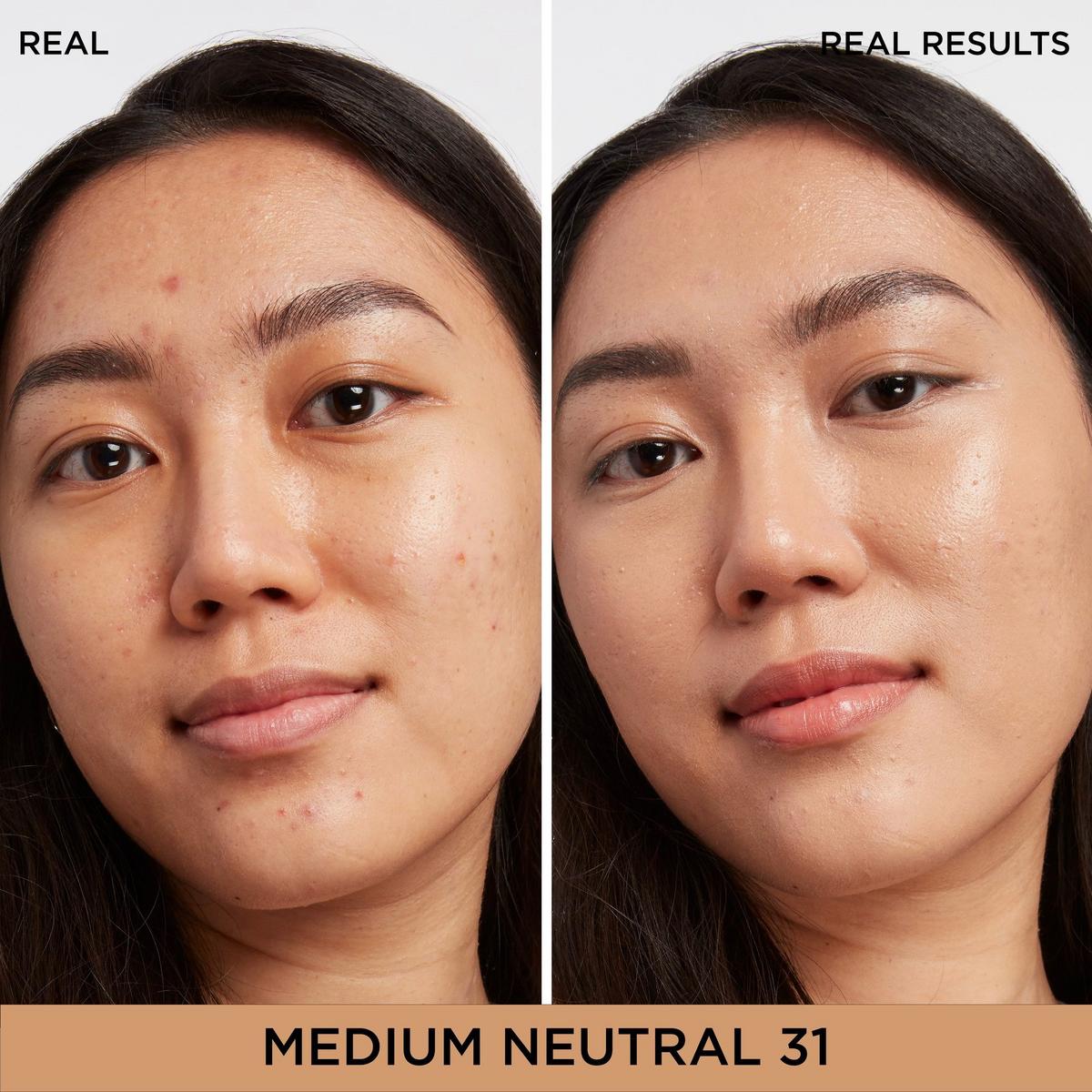 Bye Bye Dark Spots Concealer + Serum
