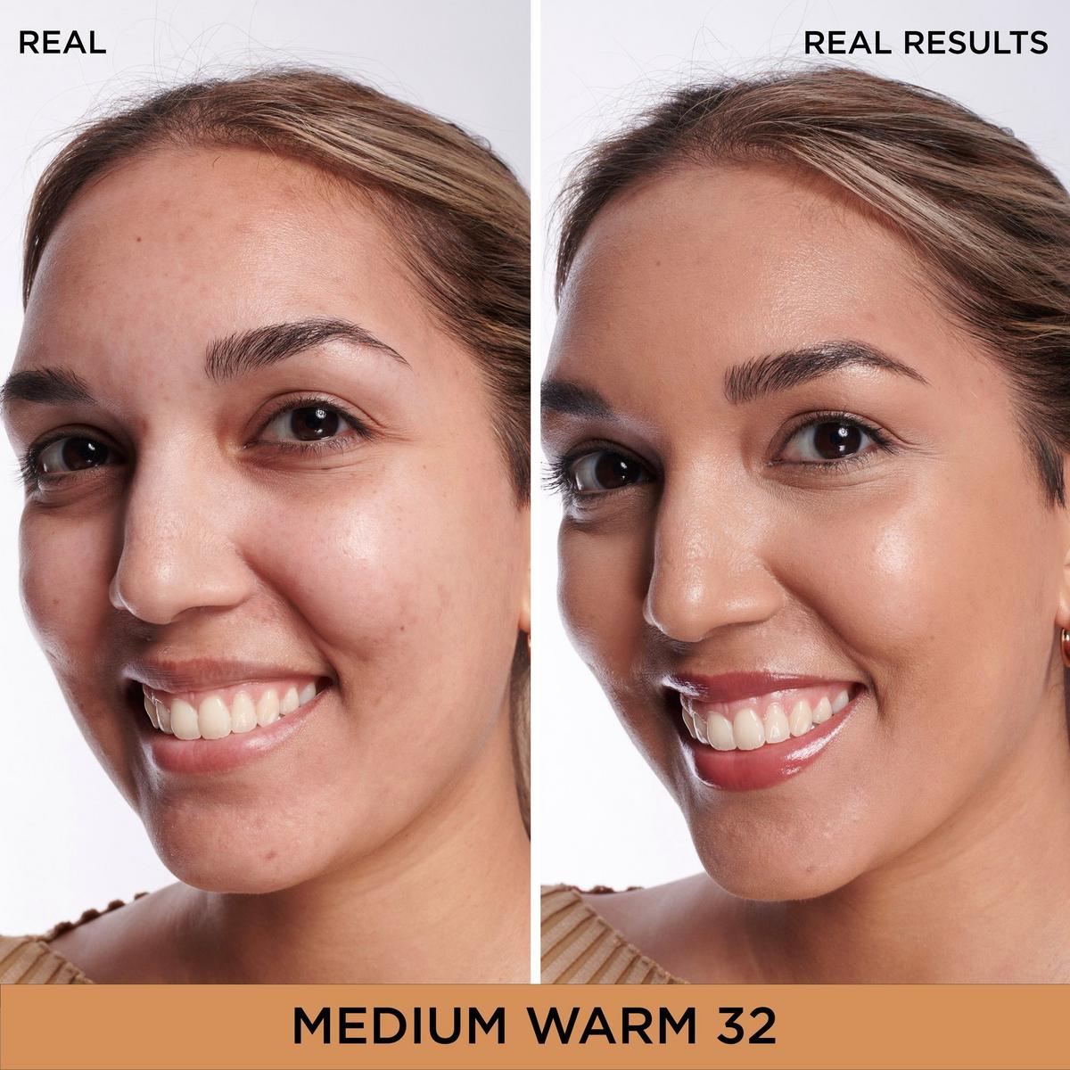 Bye Bye Dark Spots Concealer + Serum