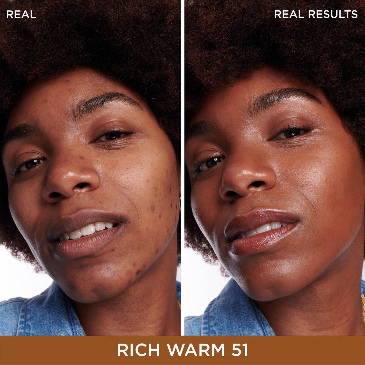 Bye Bye Dark Spots Concealer + Serum