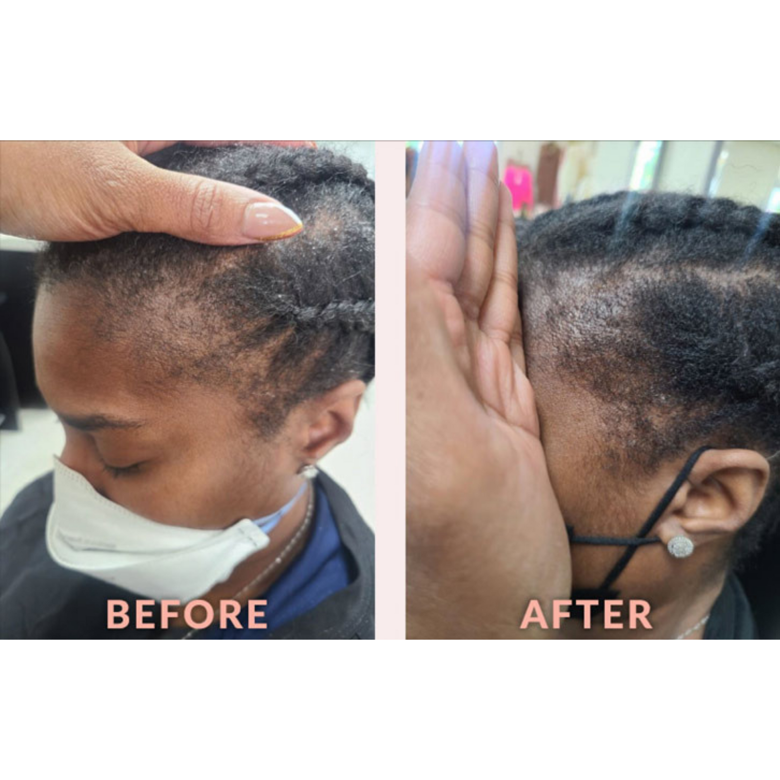 Skin & Scalp Care Edge Temple Serum