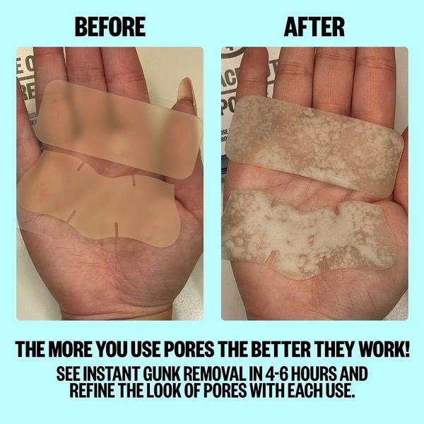 Peace Out Oil-Absorbing Pore Treatment Strips #5