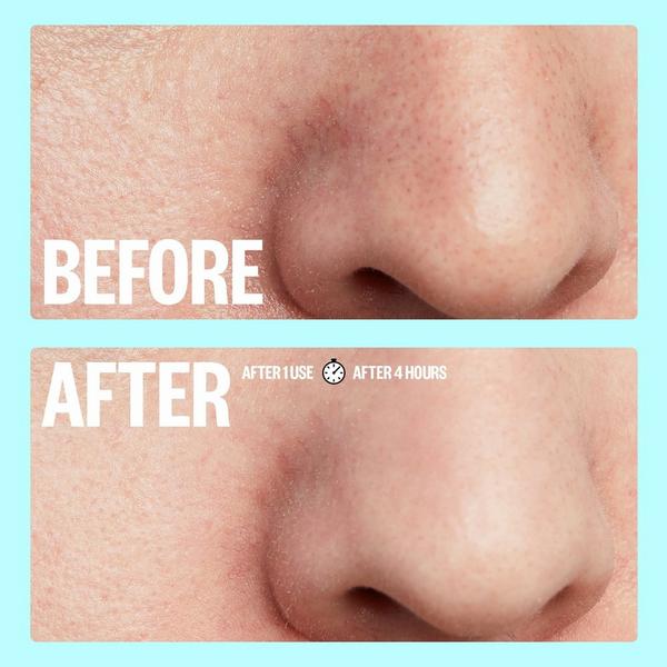 Peace Out Oil-Absorbing Pore Treatment Strips #6