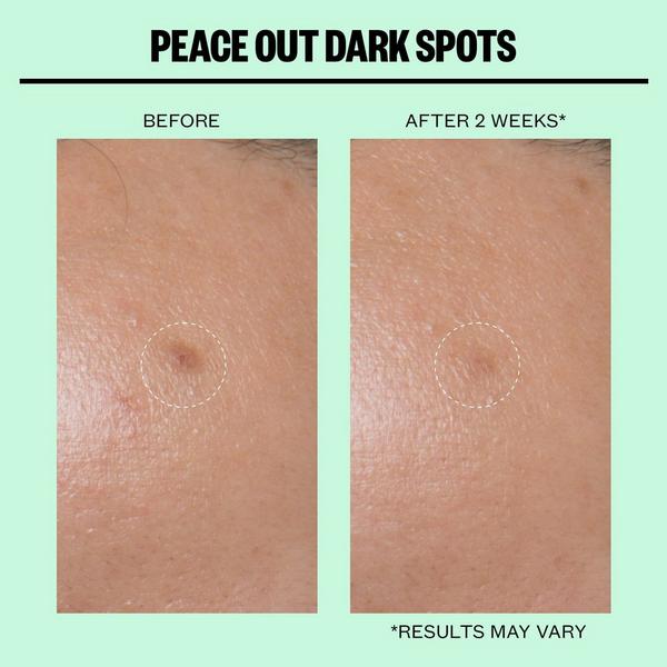 Peace Out Dark Spots Microneedling Brightening Dots #7