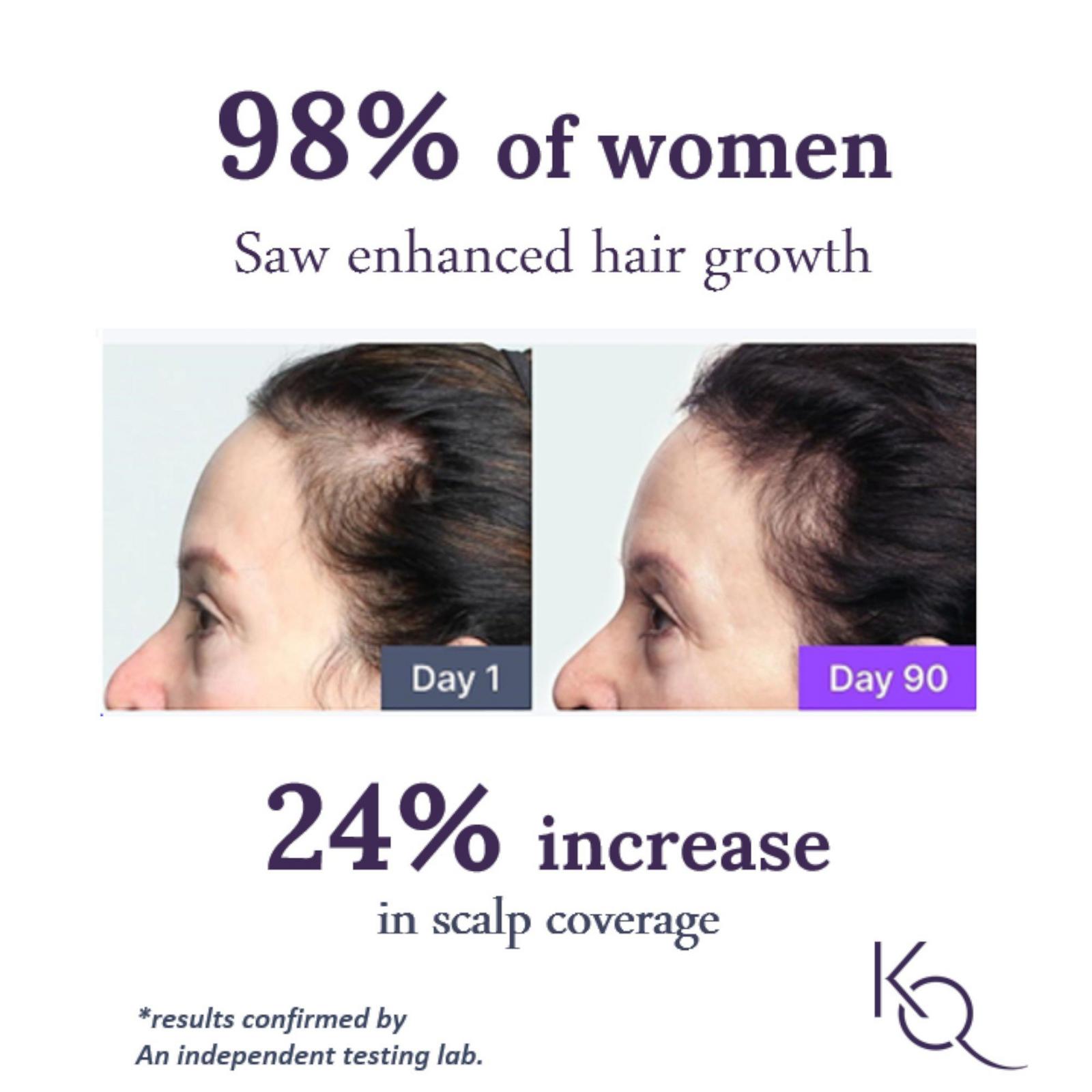 Hair Regrowth Treatment For Women - 60 Day Supply