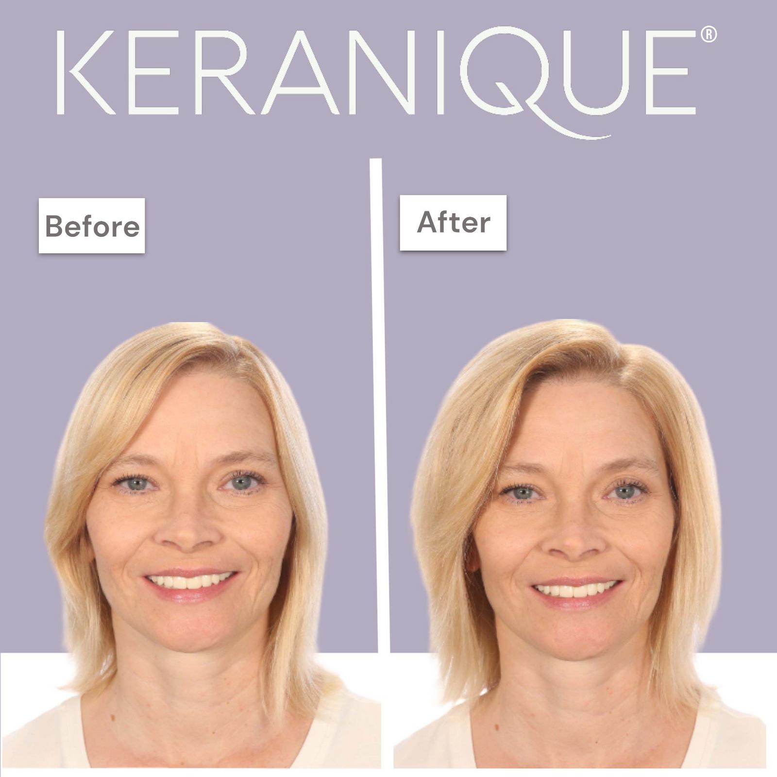 Volumizing Complete Hair Revitalizing System