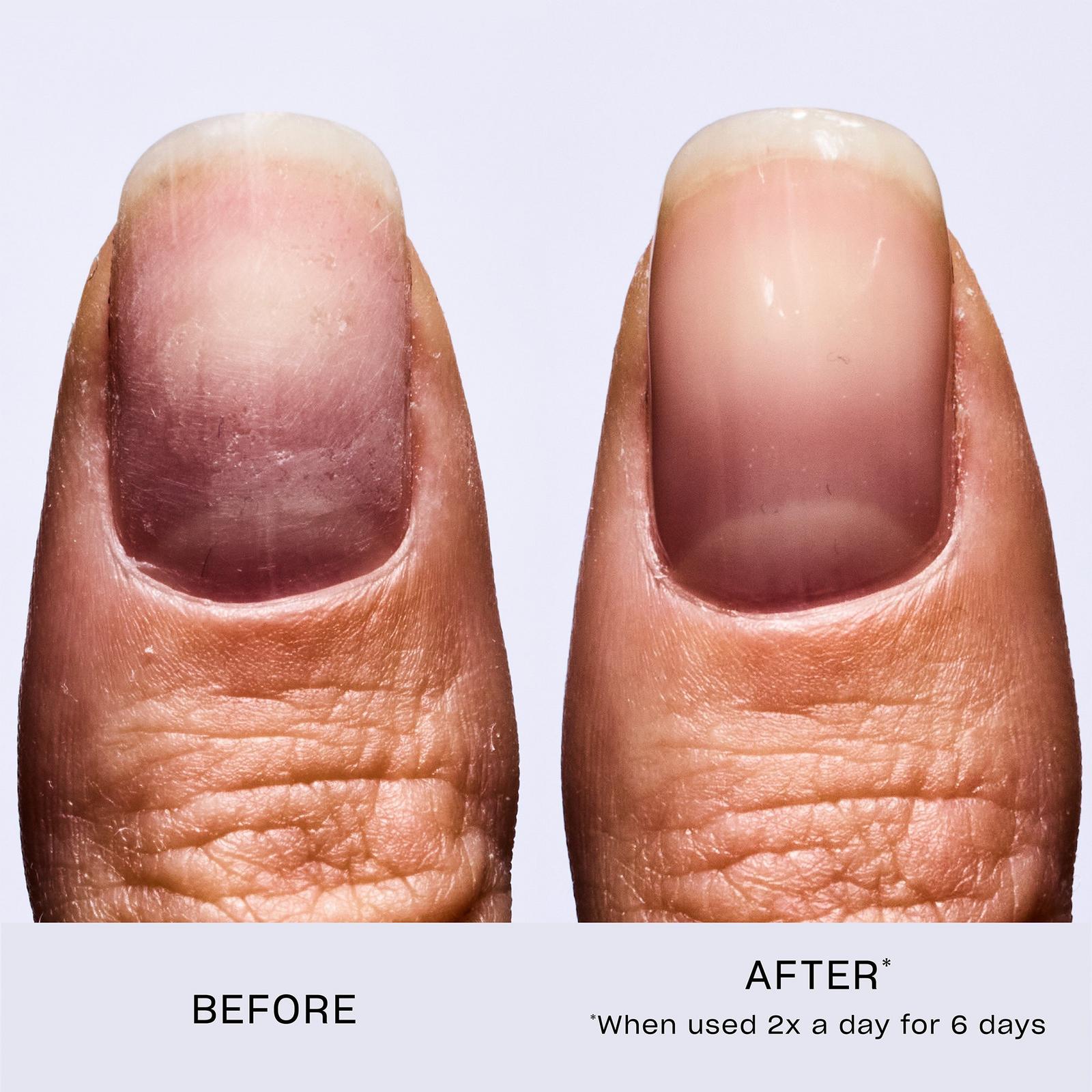 Nail Envy Original Nail Strengthener
