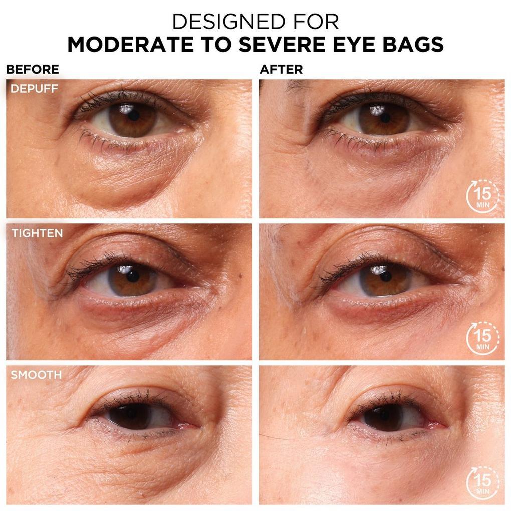 Bye Bye Under Eye Bags Daytime Treatment