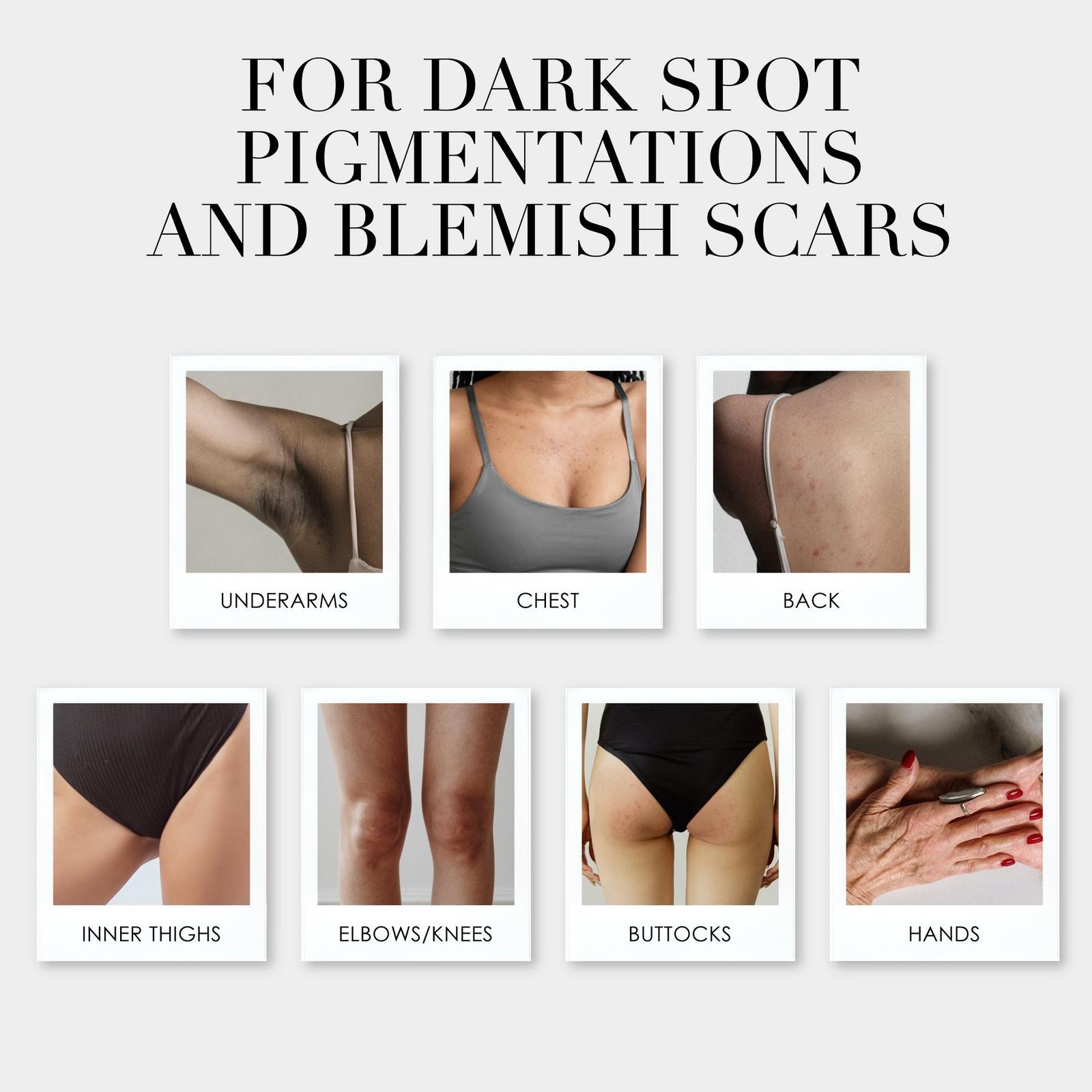 The Takesumi Bright Brightening Bar With Kojic Acid for Underarm and Body Dark Spots
