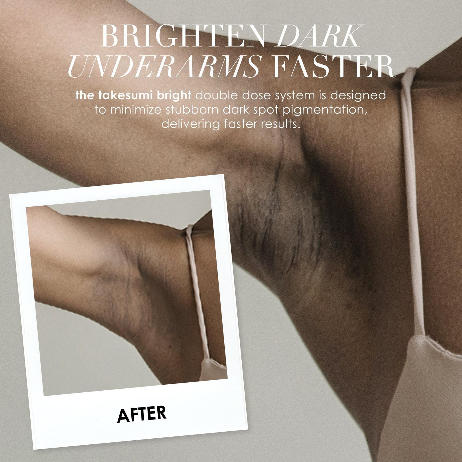 The Takesumi Bright Brightening Bar With Kojic Acid for Underarm and Body Dark Spots