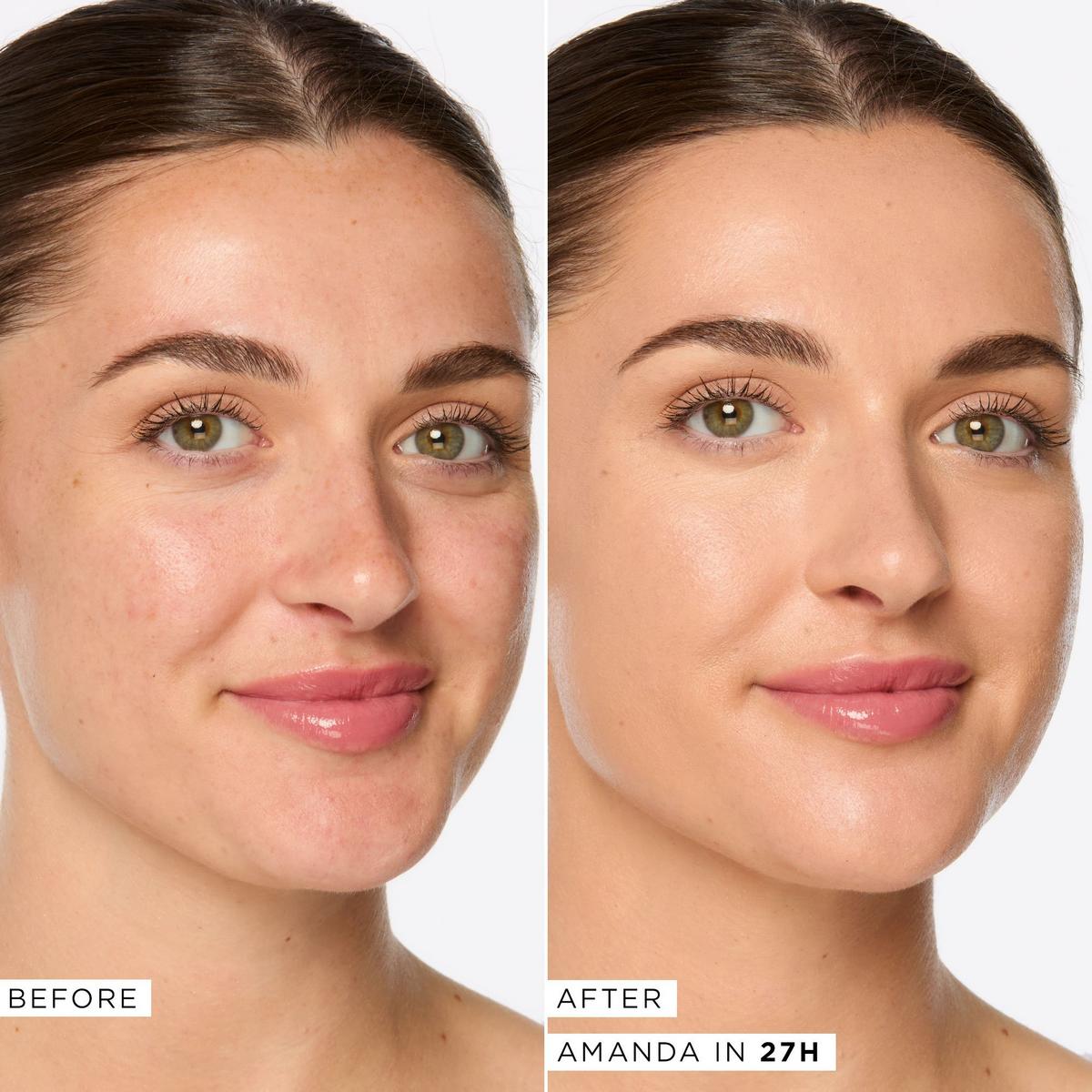 Shape Tape Radiant Medium Coverage Concealer