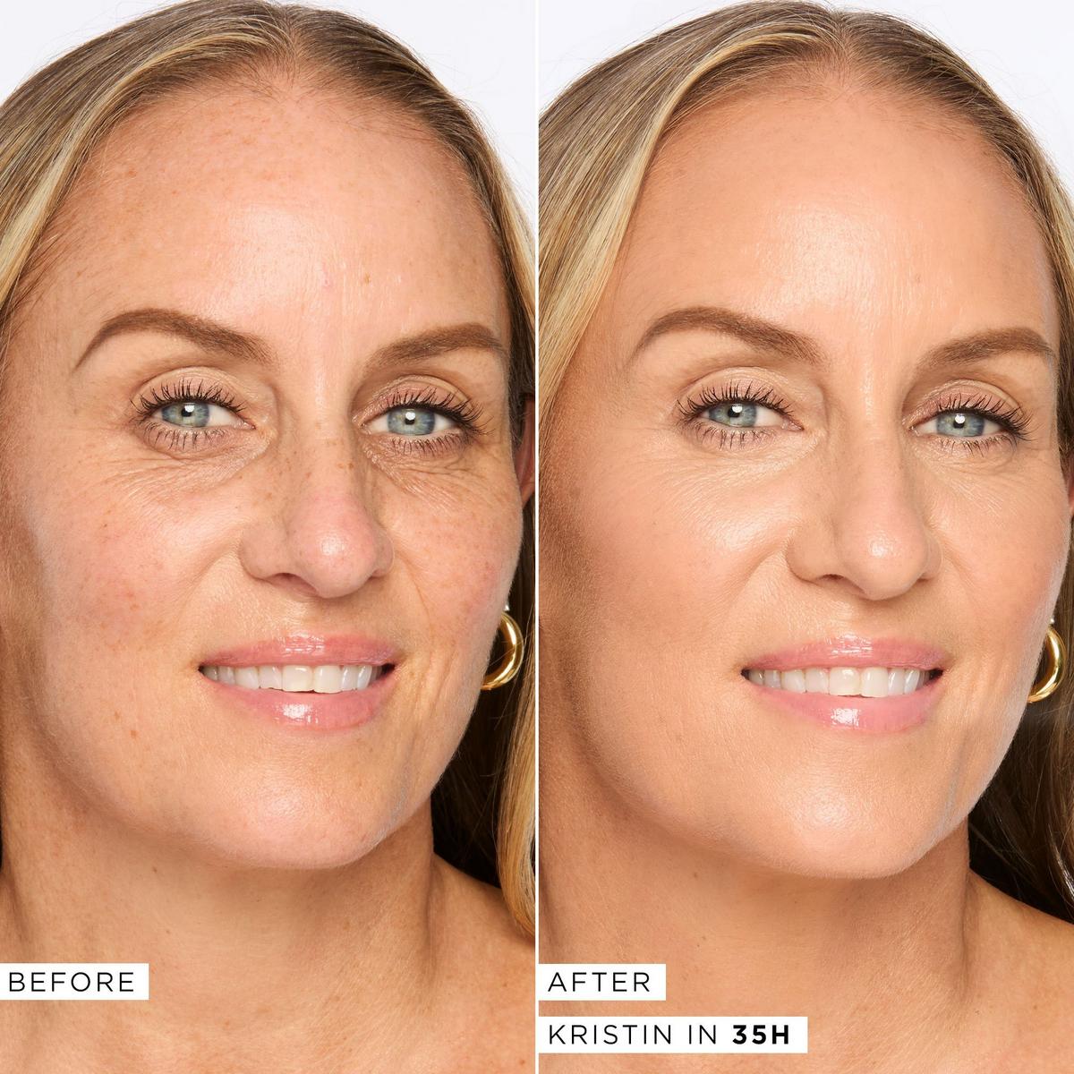 Shape Tape Radiant Medium Coverage Concealer