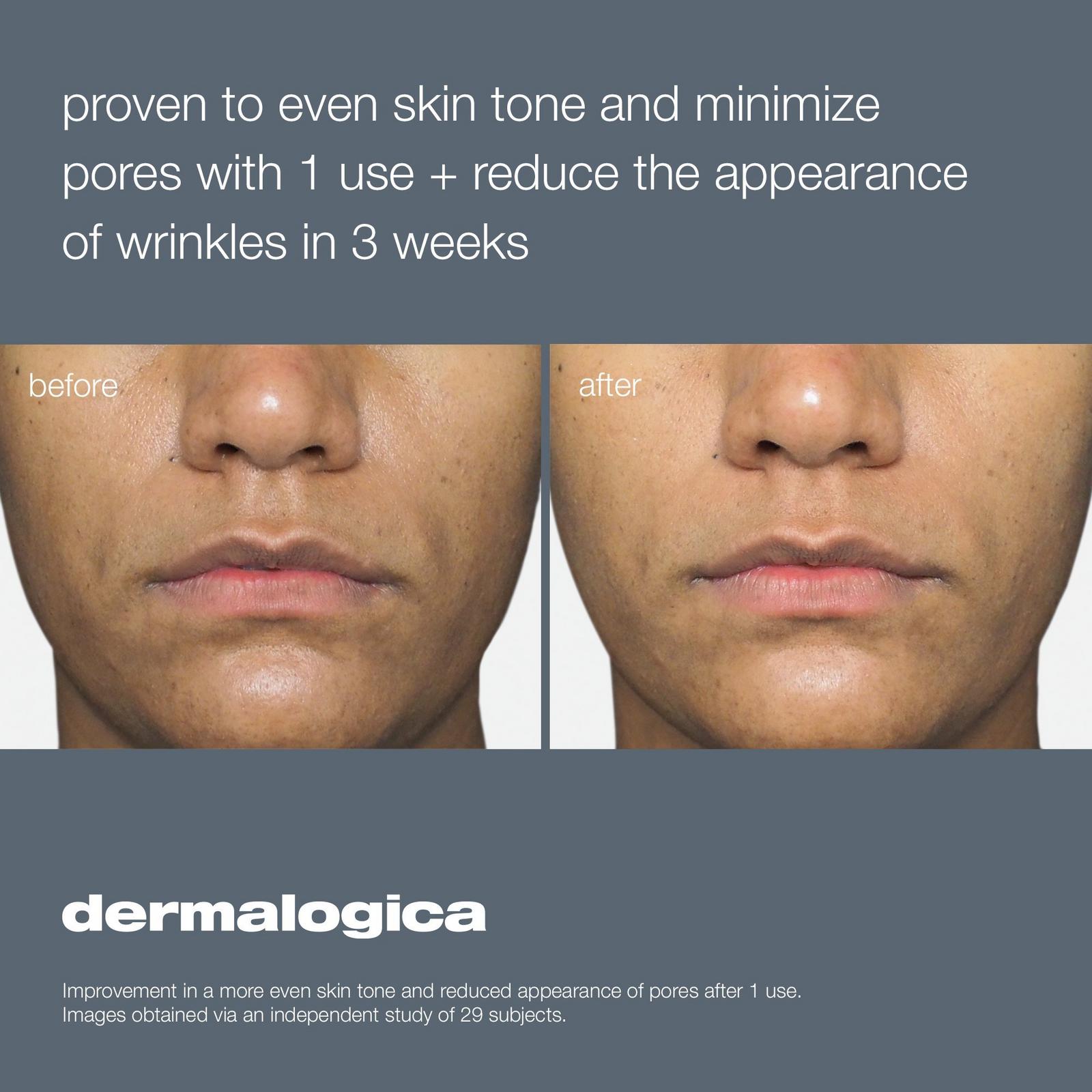 Liquid Peelfoliant Exfoliator with AHA BHA & PHA