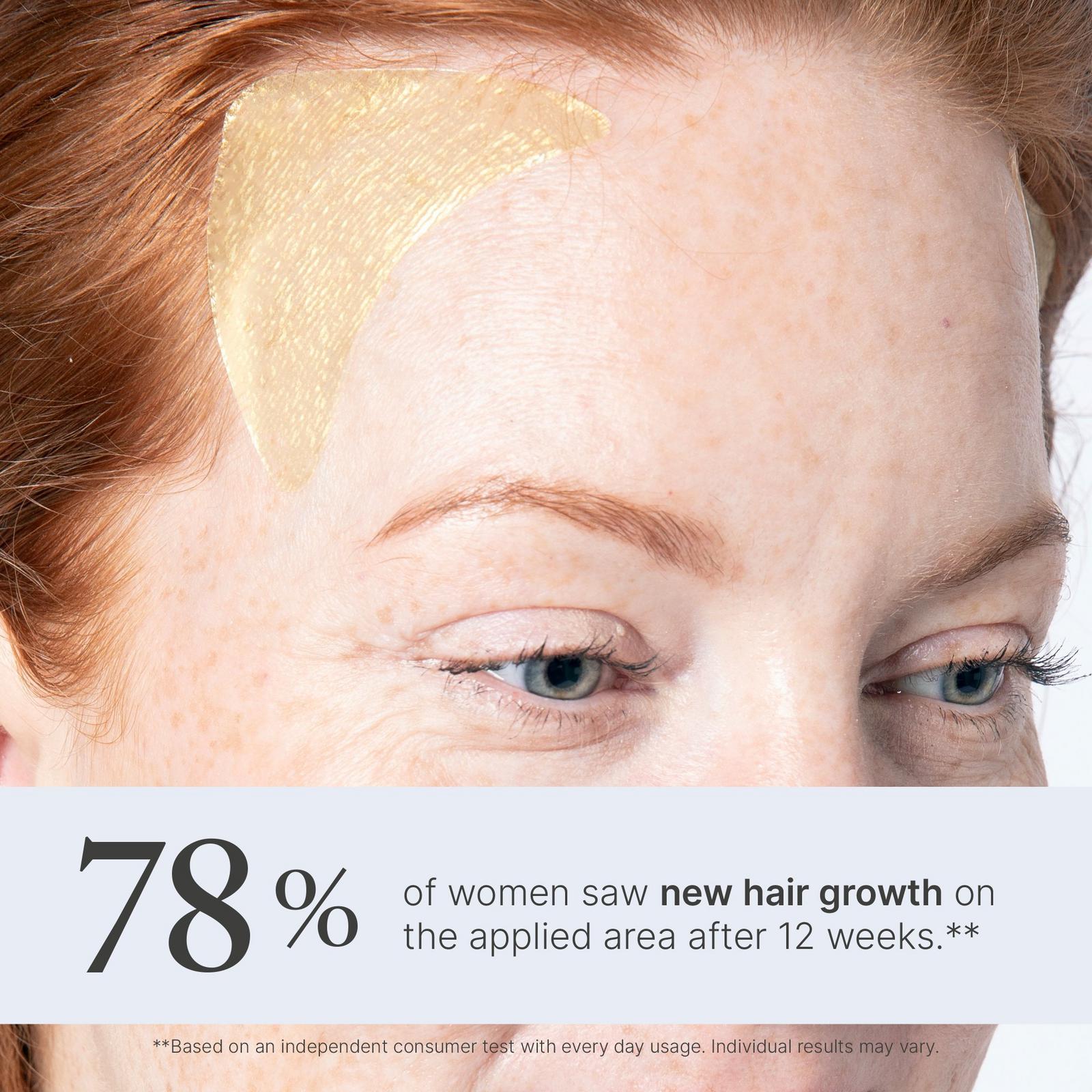 Superpower Thickening Hairpatches
