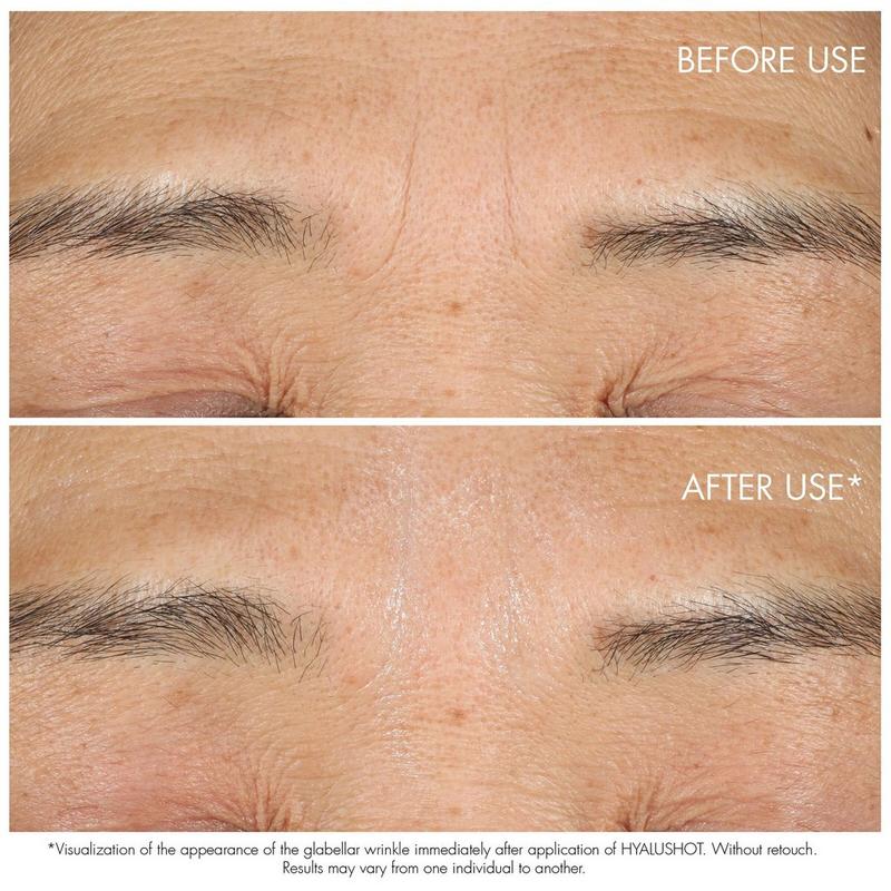 Dior - Capture Totale Hyalushot | Ulta Beauty