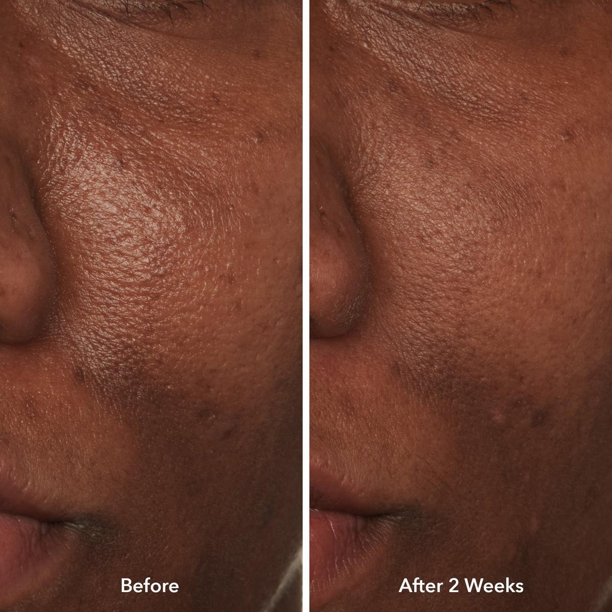 Travel Size Potato Peel Rapid Resurfacing Milk Facial