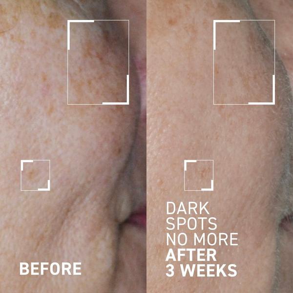 Dr. Brandt Bright This Way Dark Spots No More Triple Acid Spot Minimizing Concentrate #3