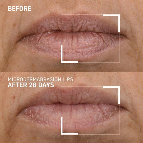 Dr. Brandt Microdermabrasion Smoothing Lip Scrub #3