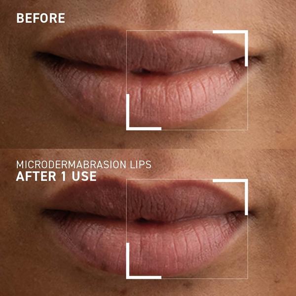 Dr. Brandt Microdermabrasion Smoothing Lip Scrub #4