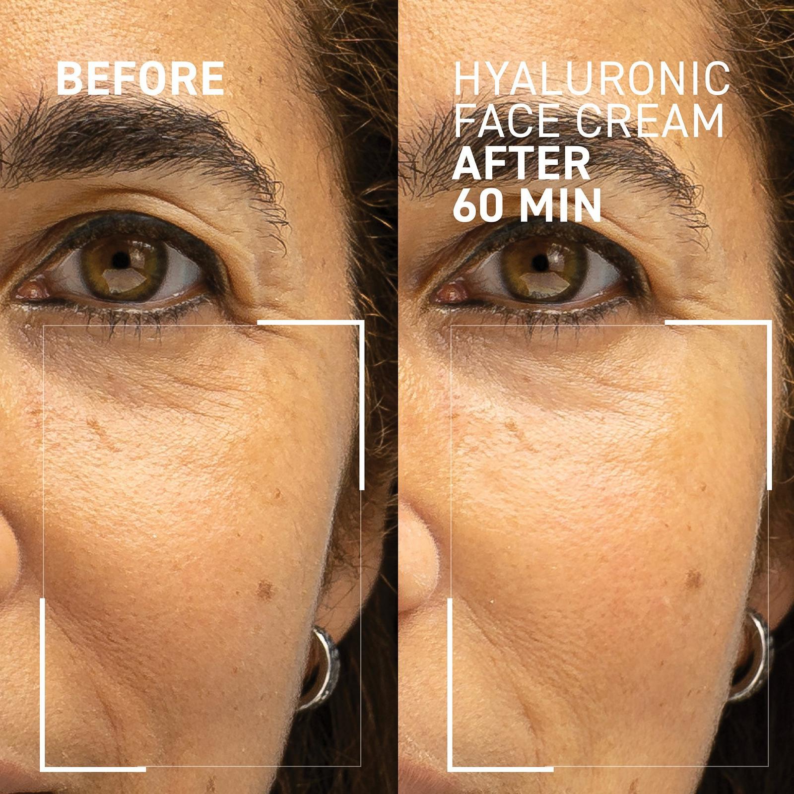 Needles No More Hyaluronic Face Cream