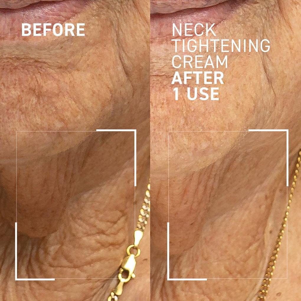 Needles No More Neck Tightening Cream - Dr. Brandt